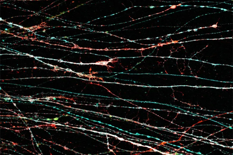 axons